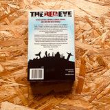 The Red Eye: A Manchester United Fan's Distorted View of the World